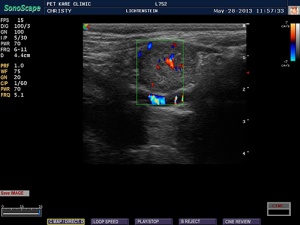 3-ultrasound