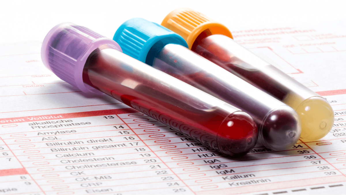 Differential Blood Test Uses, Procedure, And Results, 53 OFF
